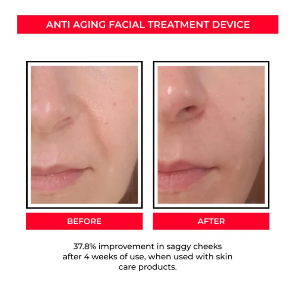 EMS Microcurrent Facial Tool