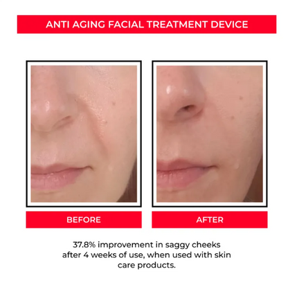 EMS Microcurrent Facial Tool